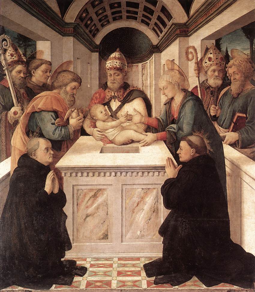 Relic of St. Peregrine Laziosi